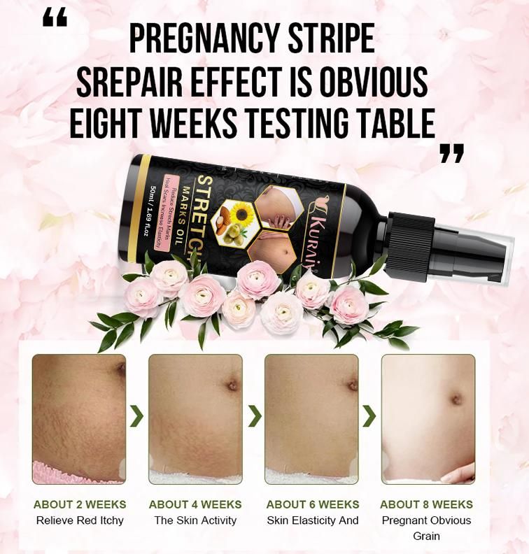 SparkPetal Natural Stretch Marks Removal Oil - Heal Pregnancy, Breast, Hip, Legs Marks (50ml)