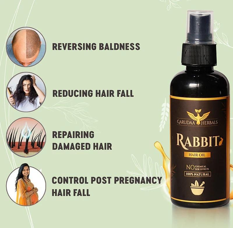 Rabbit Blood Hair Growth Oil 30ml – Reduces Hair Fall & Dandruff | Scalp Soothing & Hair Strengthening Formula for Men & Women